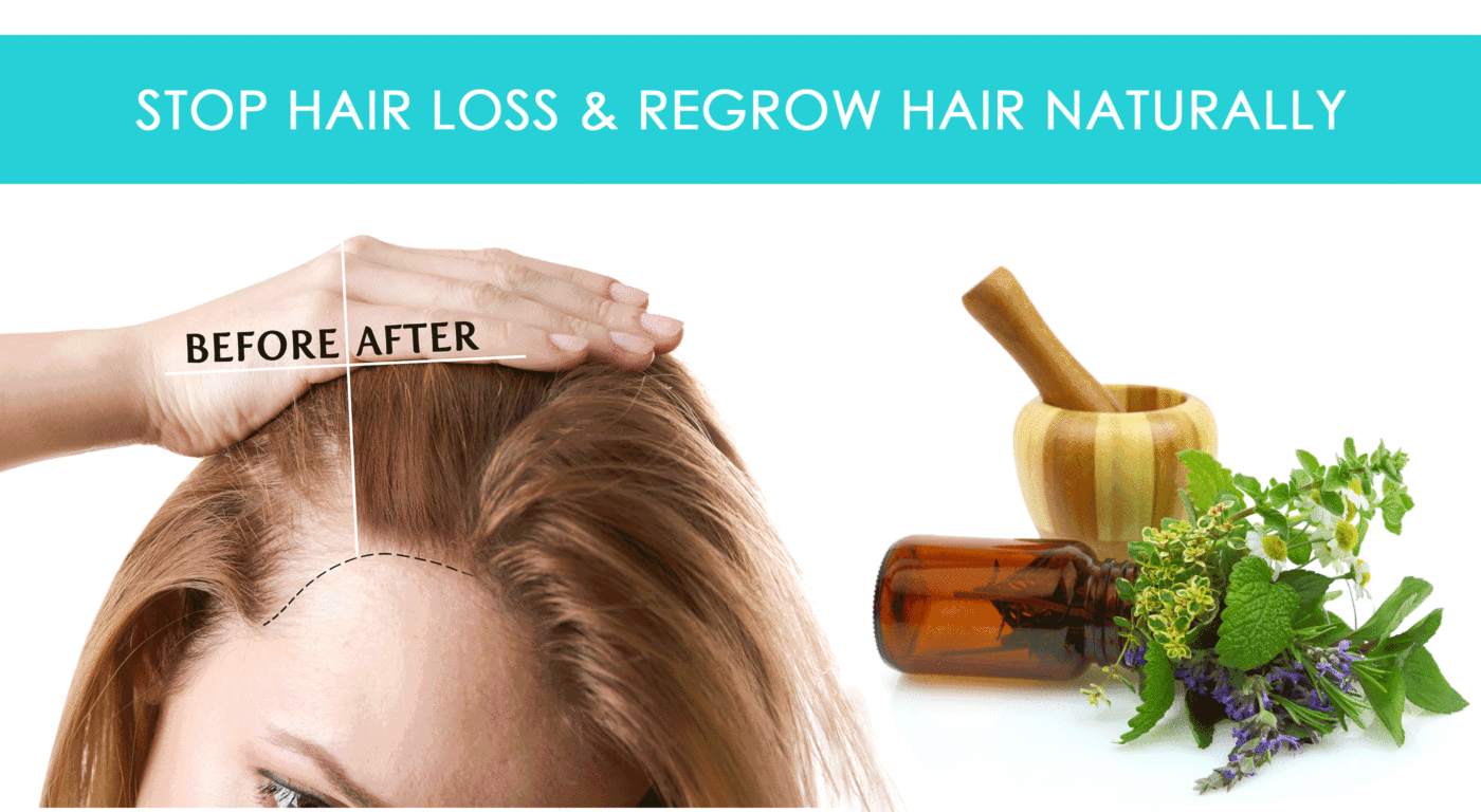 Ayurvedic Solutions for Baldness - Natural Products online